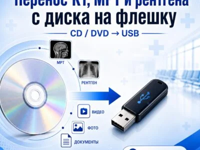 Перенос КТ, МРТ и рентгена с диска на флешку в Ногинске